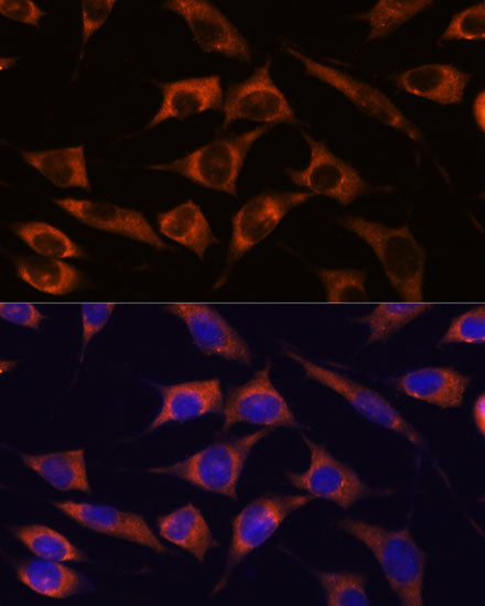 MMP25 Rabbit Polyclonal Antibody - Image 6