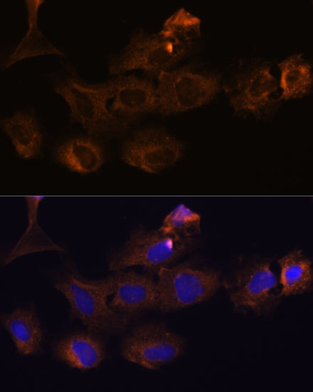 MMP25 Rabbit Polyclonal Antibody - Image 2