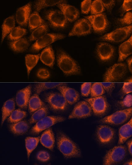 MMP25 Rabbit Polyclonal Antibody - Image 3