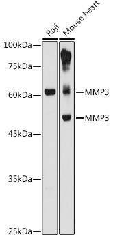 MMP3 Rabbit Polyclonal Antibody