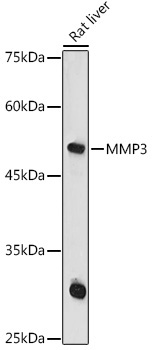MMP3 Rabbit Polyclonal Antibody - Image 2
