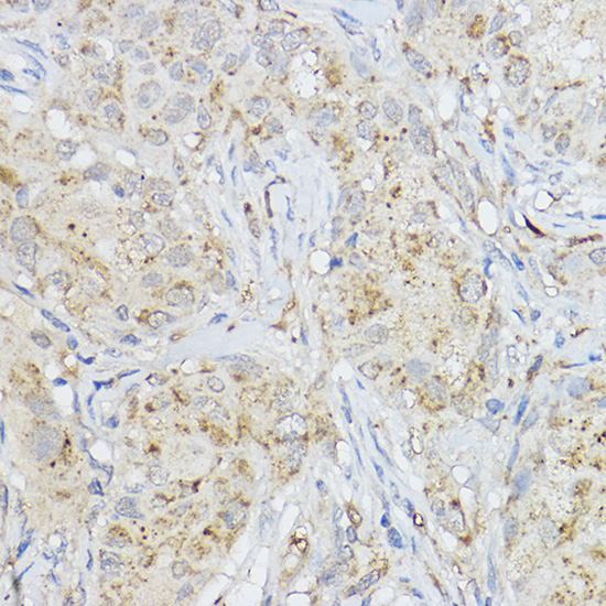 MMP3 Rabbit Polyclonal Antibody - Image 3