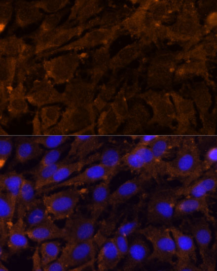 MMP3 Rabbit Polyclonal Antibody - Image 4