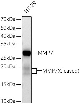 MMP7 Rabbit Polyclonal Antibody