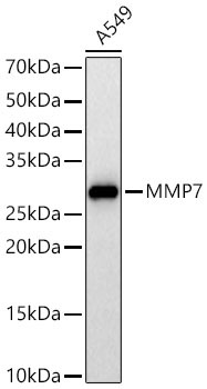 MMP7 Rabbit Polyclonal Antibody - Image 2