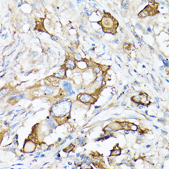 MMP7 Rabbit Polyclonal Antibody - Image 3