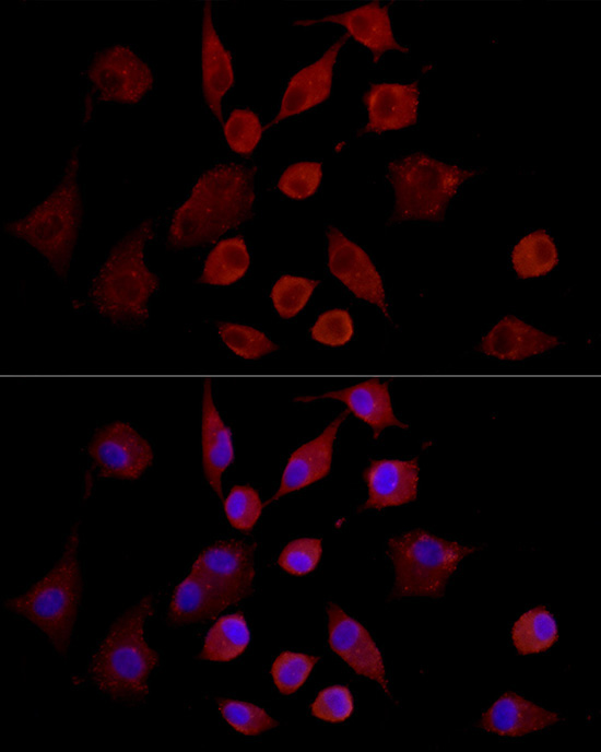 MMP7 Rabbit Polyclonal Antibody - Image 4