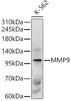 MMP9 Rabbit Polyclonal Antibody