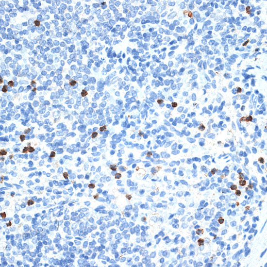 MMP9 Rabbit Polyclonal Antibody - Image 2