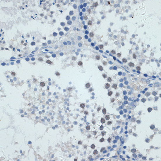 MMP9 Rabbit Polyclonal Antibody - Image 3