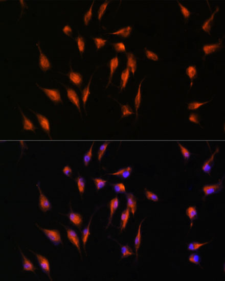 MMP9 Rabbit Polyclonal Antibody - Image 5