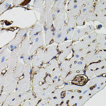 MMP9 Rabbit Polyclonal Antibody