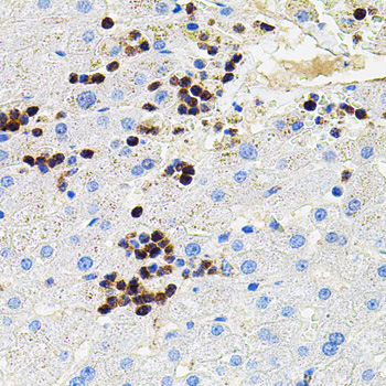 MMP9 Rabbit Polyclonal Antibody - Image 2