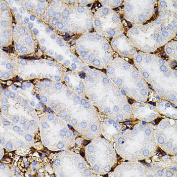 MMP9 Rabbit Polyclonal Antibody - Image 4