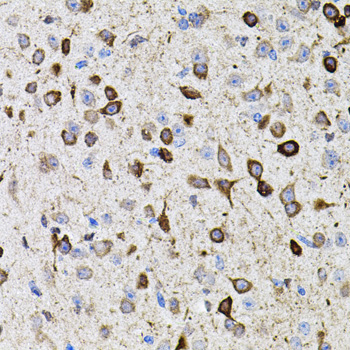 MMP9 Rabbit Polyclonal Antibody - Image 2