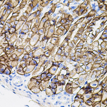 MMP9 Rabbit Polyclonal Antibody - Image 4
