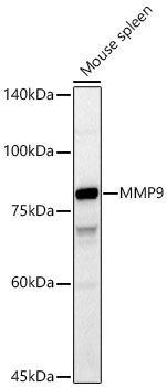 MMP9 Rabbit Polyclonal Antibody