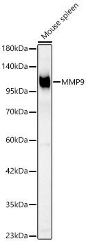 MMP9 Rabbit Polyclonal Antibody