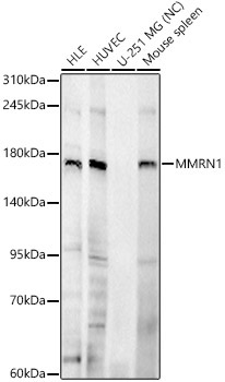 MMRN1 Rabbit Polyclonal Antibody