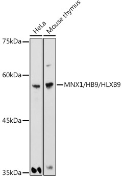 MNX1/HB9/HLXB9 Rabbit Polyclonal Antibody