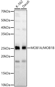 MOB1A/MOB1B Rabbit Polyclonal Antibody