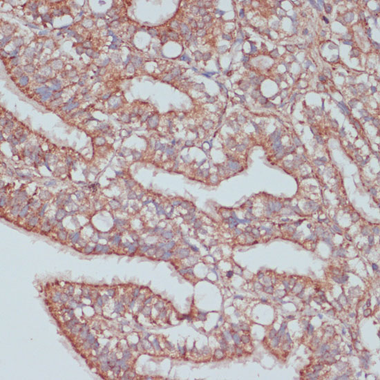MOB4 Rabbit Polyclonal Antibody - Image 2