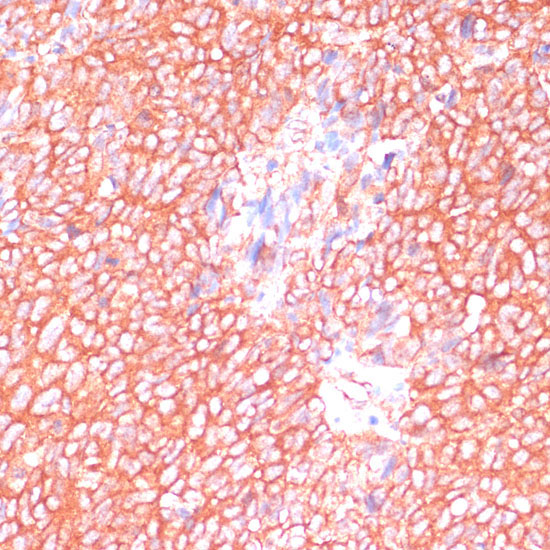MOB4 Rabbit Polyclonal Antibody - Image 3
