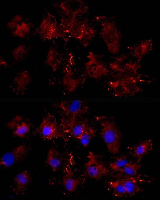 Moesin Rabbit Polyclonal Antibody - Image 2