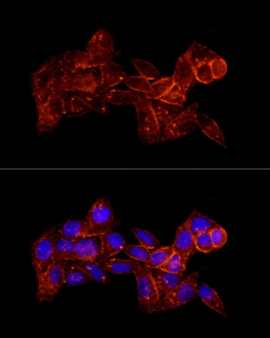 Moesin Rabbit Polyclonal Antibody - Image 3