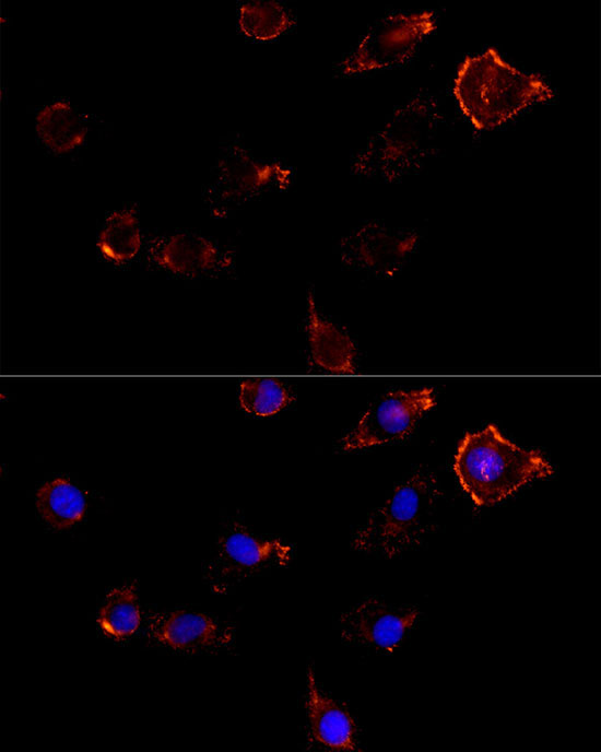 Moesin Rabbit Polyclonal Antibody - Image 4