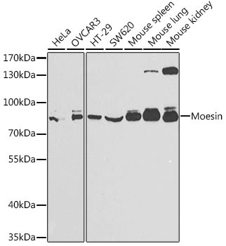 Moesin Rabbit Polyclonal Antibody