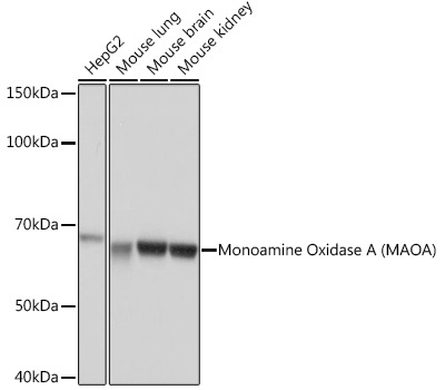 Monoamine Oxidase A (MAOA) Rabbit Monoclonal Antibody