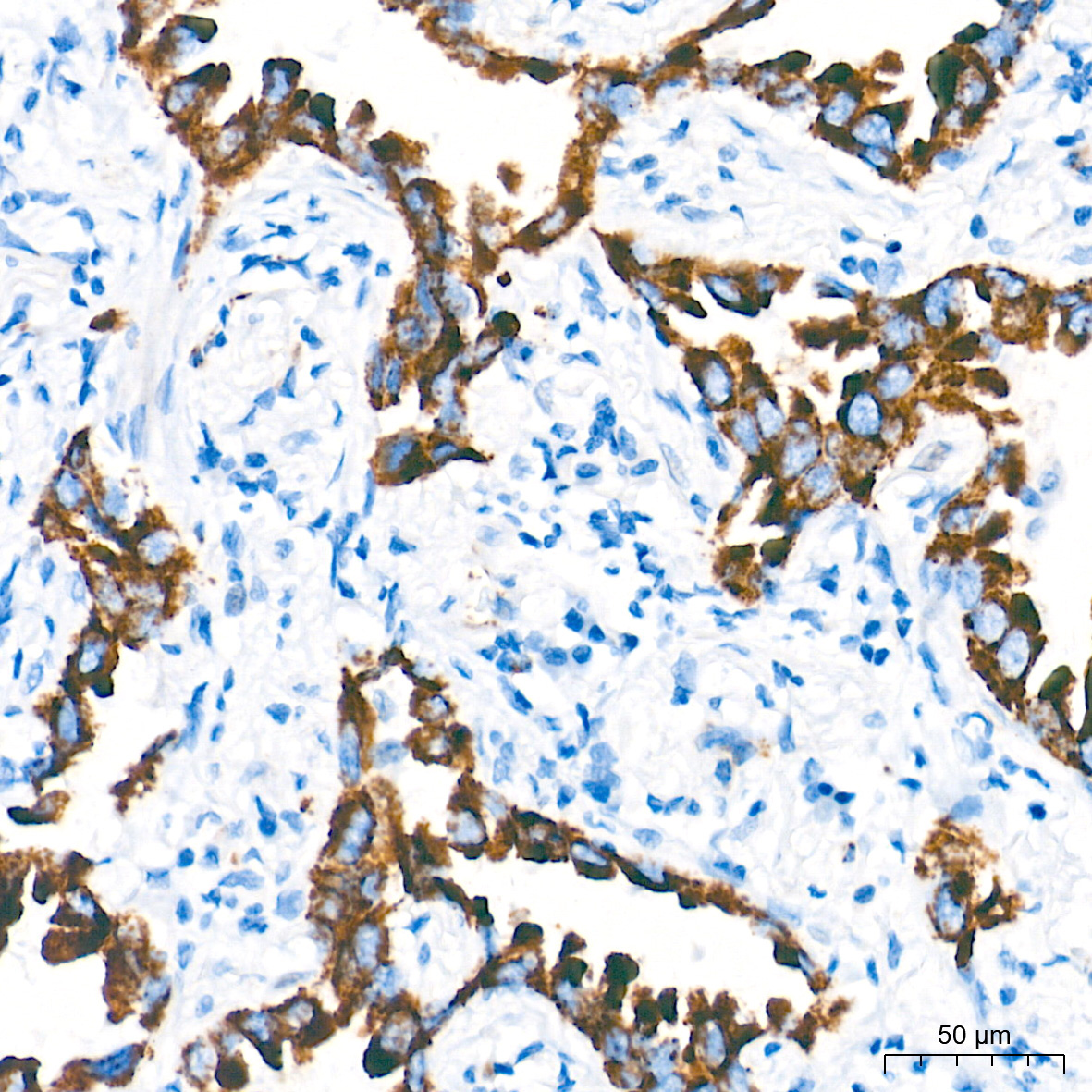Monoamine Oxidase A (MAOA) Rabbit Monoclonal Antibody - Image 4