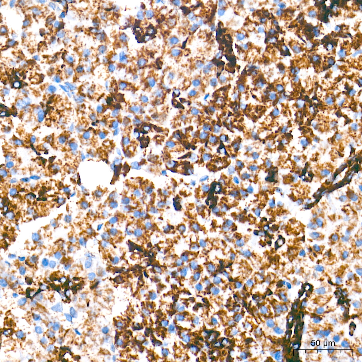 Monoamine Oxidase A (MAOA) Rabbit Monoclonal Antibody - Image 5