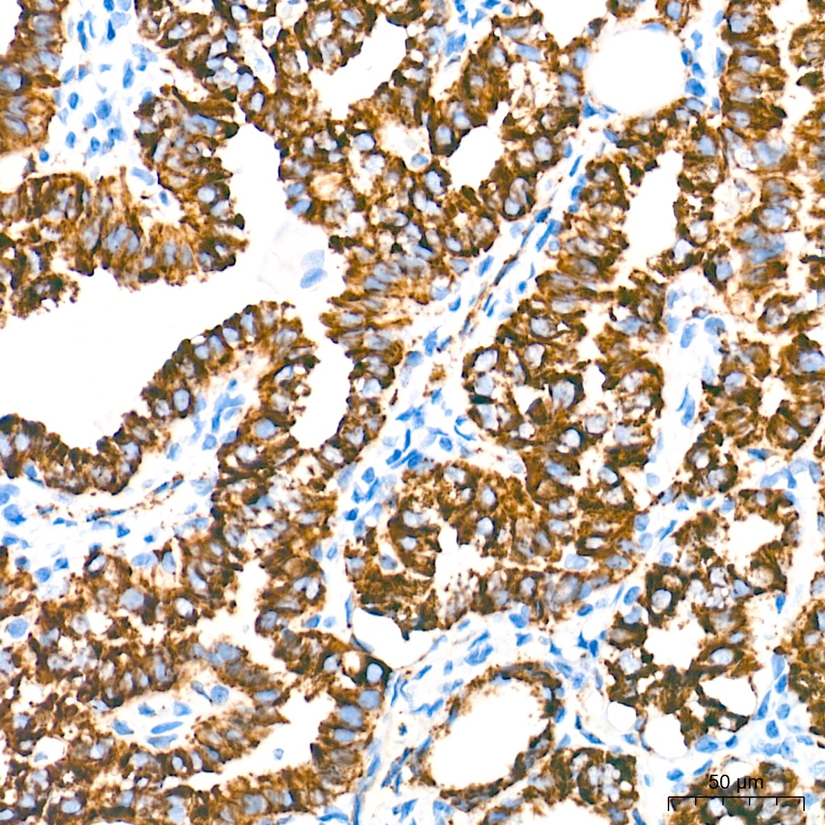 Monoamine Oxidase A (MAOA) Rabbit Monoclonal Antibody - Image 6