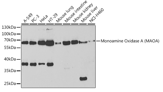 Monoamine Oxidase A (MAOA) Rabbit Polyclonal Antibody