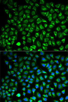 Monoamine Oxidase A (MAOA) Rabbit Polyclonal Antibody