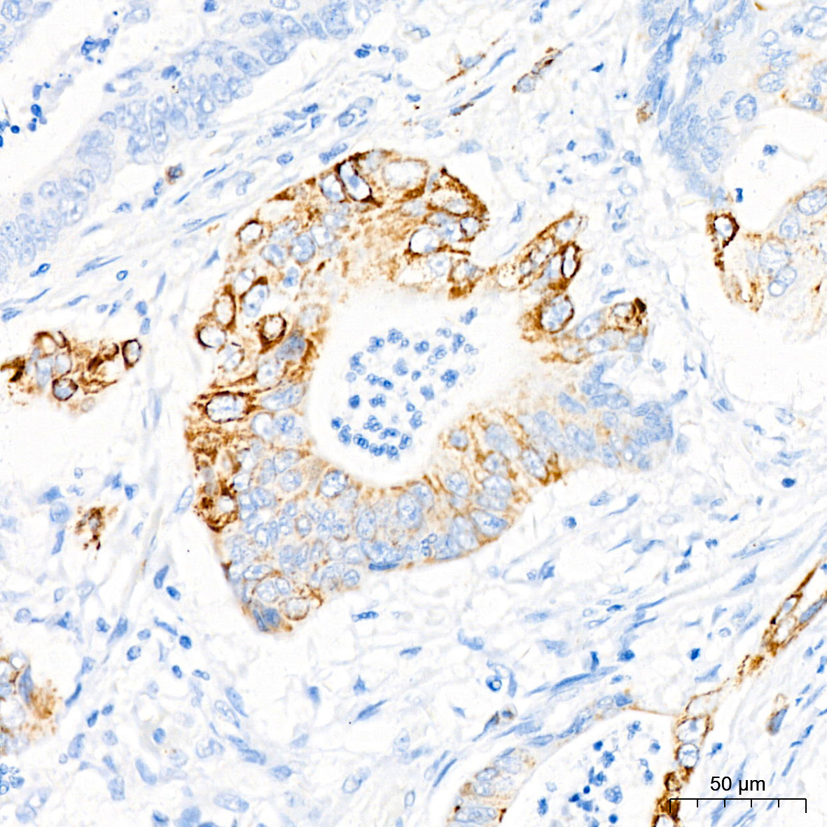 Monoamine Oxidase B (MAOB) Rabbit Monoclonal Antibody - Image 2