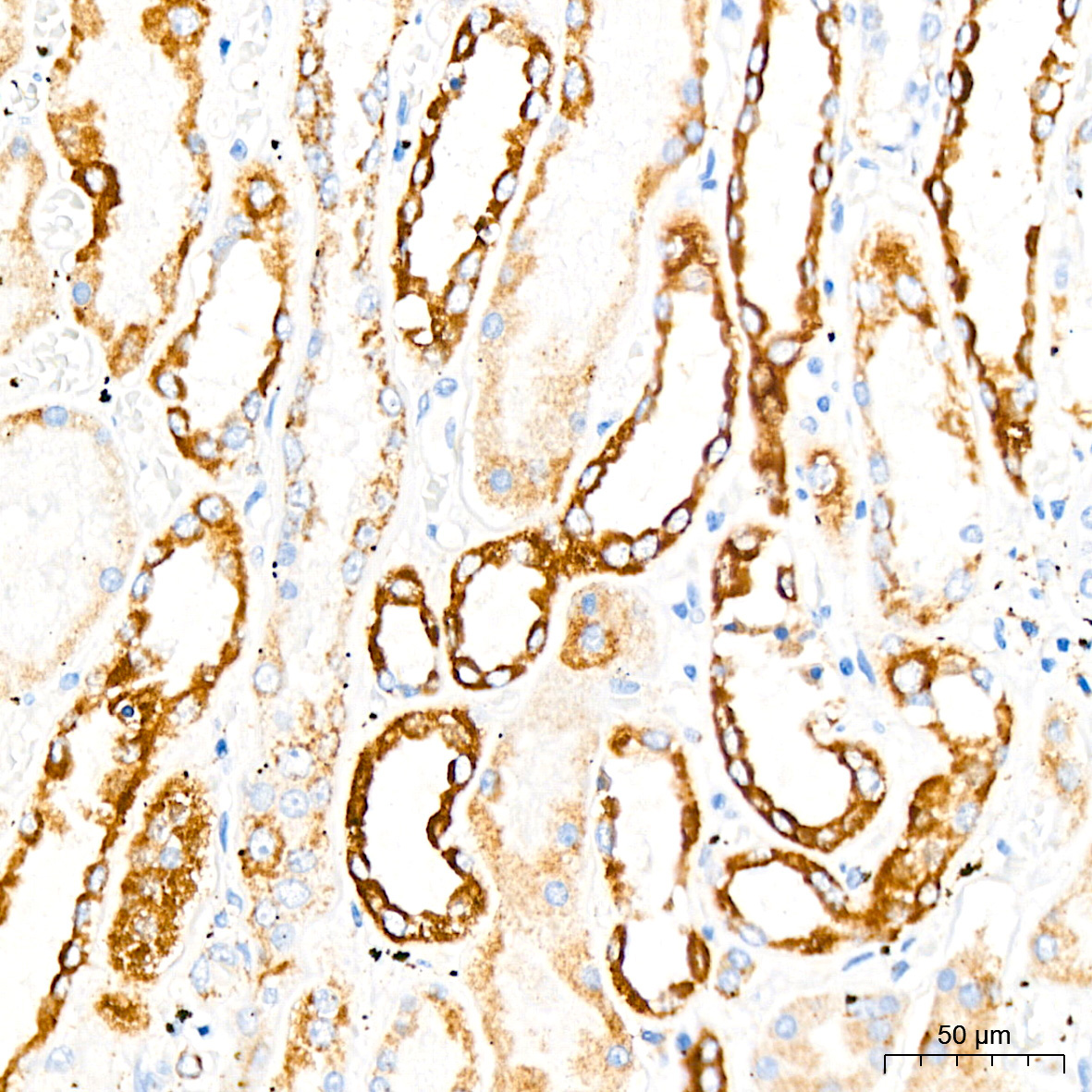 Monoamine Oxidase B (MAOB) Rabbit Monoclonal Antibody - Image 3