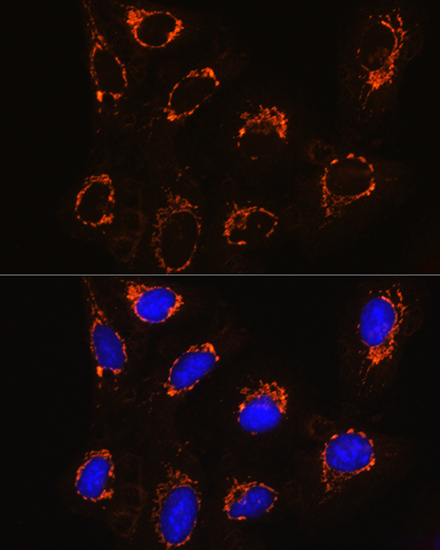 Monoamine Oxidase B (MAOB) Rabbit Polyclonal Antibody - Image 8