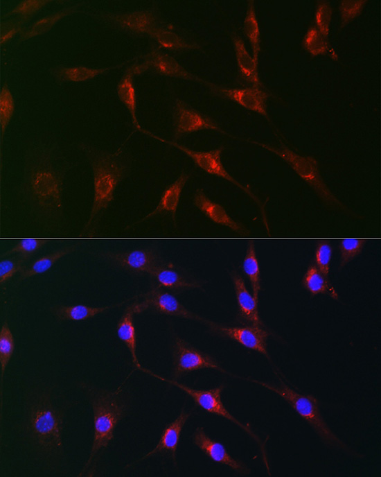 Monoamine Oxidase B (MAOB) Rabbit Polyclonal Antibody - Image 9