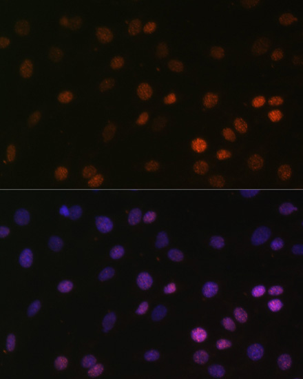 MonoMethyl-Histone H2B-K5 Rabbit Polyclonal Antibody - Image 2