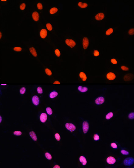 MonoMethyl-Histone H2B-K5 Rabbit Polyclonal Antibody - Image 3