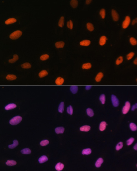 MonoMethyl-Histone H2B-K5 Rabbit Polyclonal Antibody - Image 4