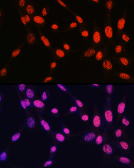 MonoMethyl-Histone H2B-K5 Rabbit Polyclonal Antibody - Image 5