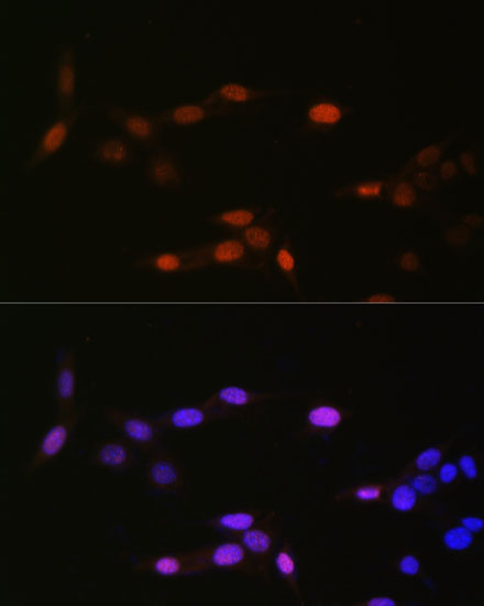 MonoMethyl-Histone H3-K14 Rabbit Polyclonal Antibody - Image 2