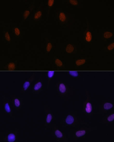 MonoMethyl-Histone H3-K14 Rabbit Polyclonal Antibody - Image 3