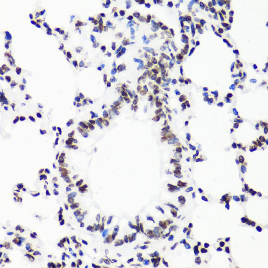 MonoMethyl-Histone H3-R17 Rabbit Polyclonal Antibody - Image 3