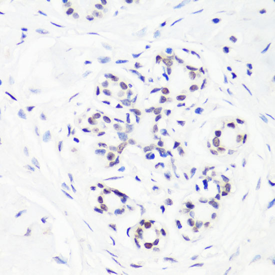 MonoMethyl-Histone H3-R17 Rabbit Polyclonal Antibody - Image 4