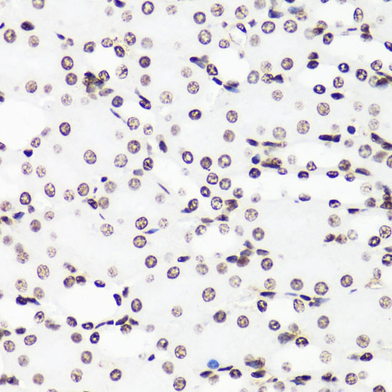 MonoMethyl-Histone H3-R17 Rabbit Polyclonal Antibody - Image 5